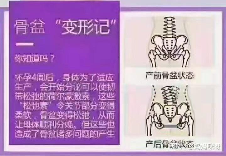 手机打游戏坐姿不当，小心脊椎变形、骨盆歪斜、腿型变差